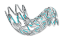 MicroPort Bridge Vertebral Artery Targeted-Eluting Stent