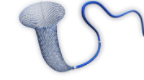 MicroPort Tubridge V5 Flow Diverter Stent
